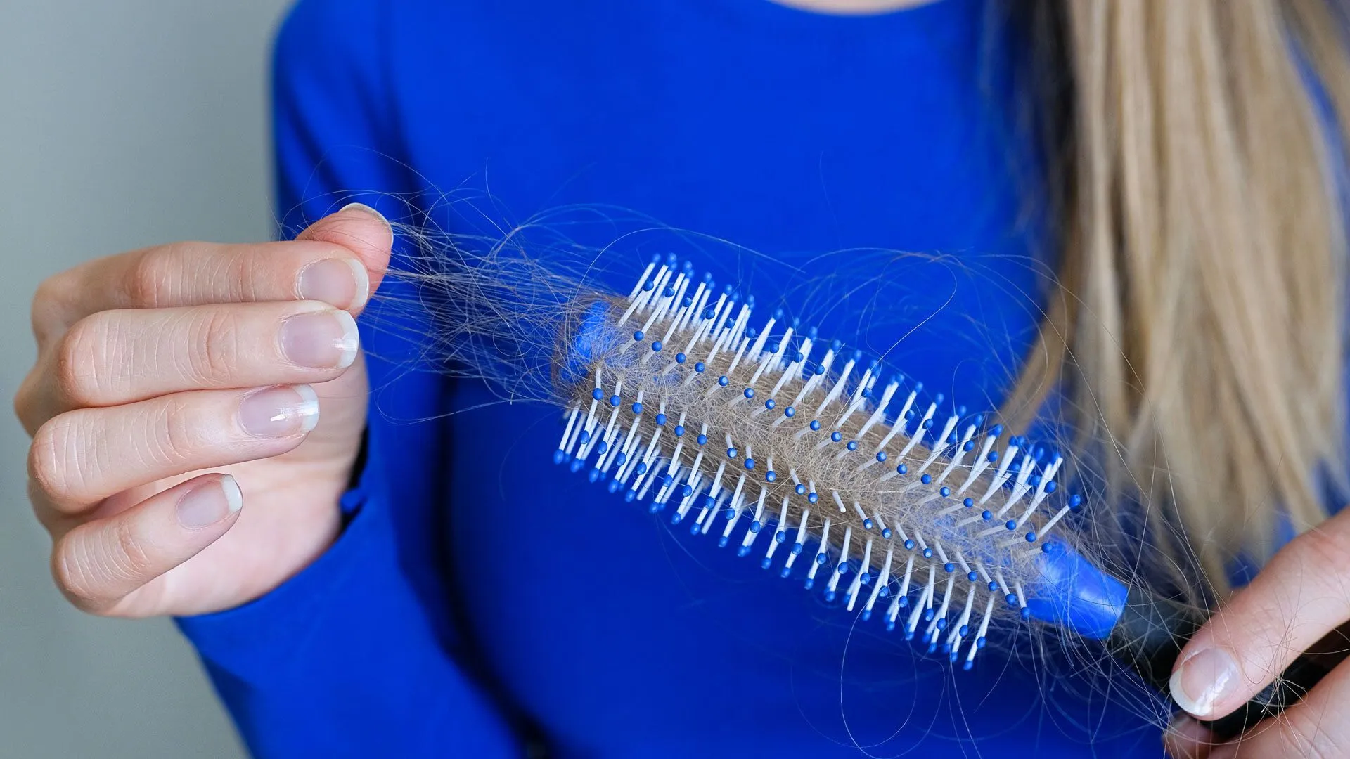 Haarausfall bei Frauen: Das sind die besten Frisuren