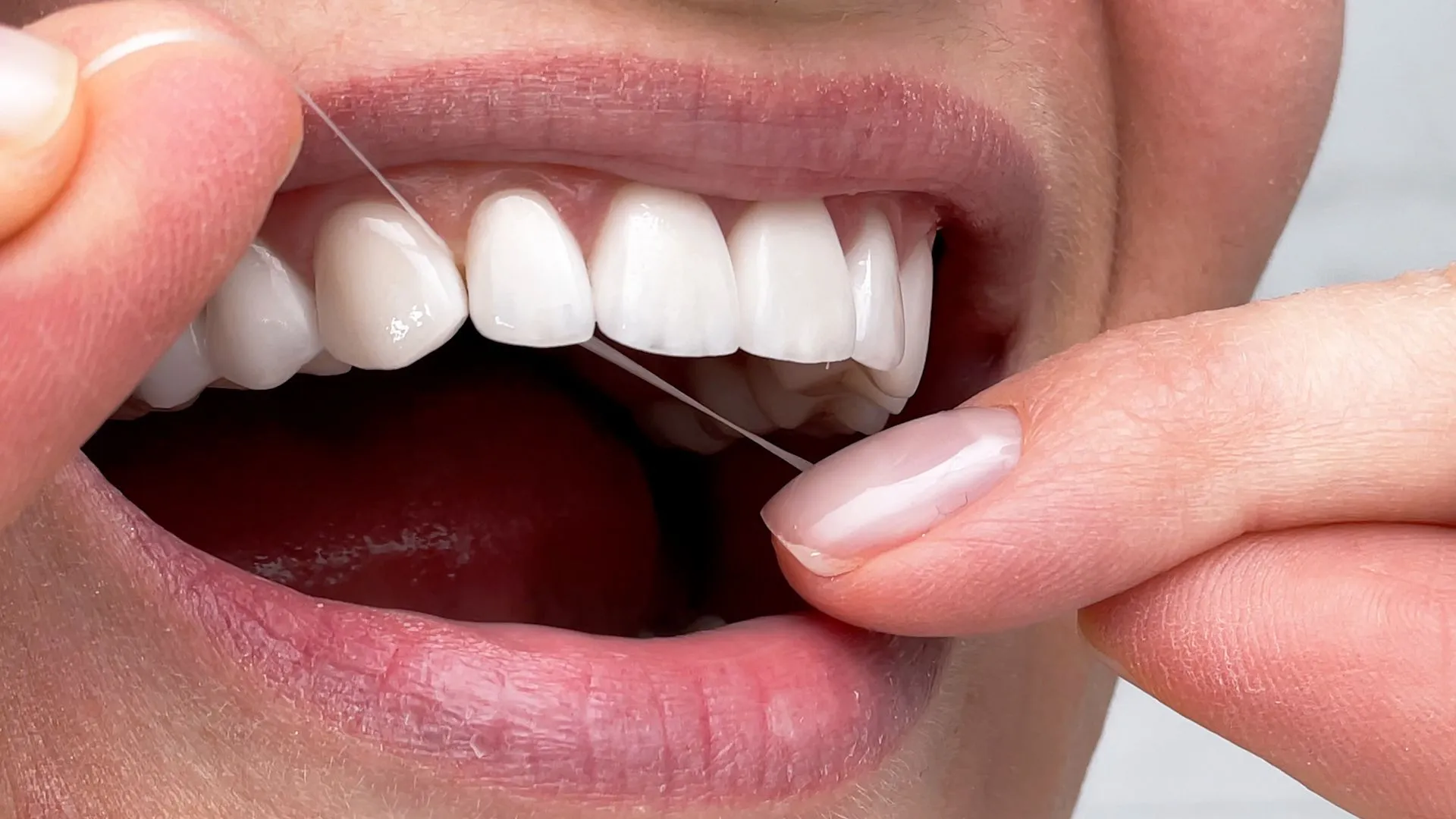 Zahnseide richtig nutzen: Lieber vor oder nach dem Zähneputzen?
