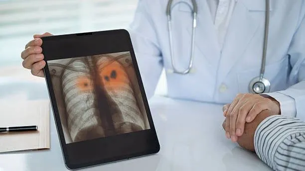 Diese Lungenkrebs-Symptome sollte jeder kennen